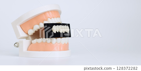 Plastic dental model holding a shade guide for dental veneers, used in cosmetic dentistry to match tooth colors accurately. Plastic dental model holding a shade guide for dental veneers, used in cosmetic dentistry to match tooth colors accurately. 128372282