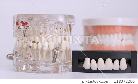 Dental implant and prosthetic teeth models display Dental implant and prosthetic teeth models display 128372296