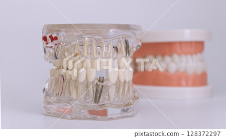 Dental implant training models for oral education 128372297
