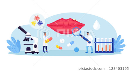 Herpes simplex virus on human lips. Dermatological disease with watery blisters in the skin. STD infection. Doctors diagnosis HSV virus. Clinical exam, visual inspection, laboratory tests 128403195