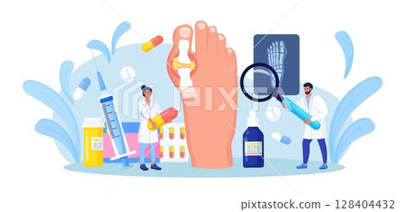Gout treatment. Arthritis joint in the ankle. Doctor diagnoses swollen and inflamed foot joint. Physician looking at x-ray scan. Human feet bone with uric acid crystals. Medical appointment and exam 128404432
