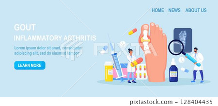 Gout treatment. Arthritis joint in the ankle. Doctor diagnoses swollen and inflamed foot joint. Physician looking at x-ray scan. Human feet bone with uric acid crystals. Medical appointment and exam 128404435