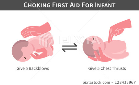 Choking First Aid For Infant cartoon illustration . Back blows and switch with chest thrusts . Flat design . Vector . 128435967