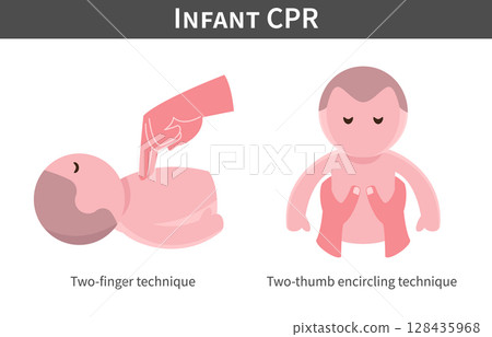 Infant CPR cartoon illustration flat design . two-finger technique and two-thumb encircling technique . Isolated on white background . Vector . 128435968