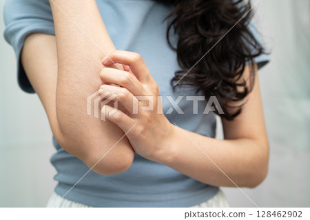 Asian woman itching of skin diseases using hand scratching. 128462902