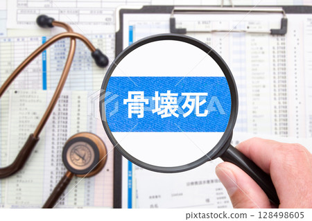 Bone necrosis medical image 128498605