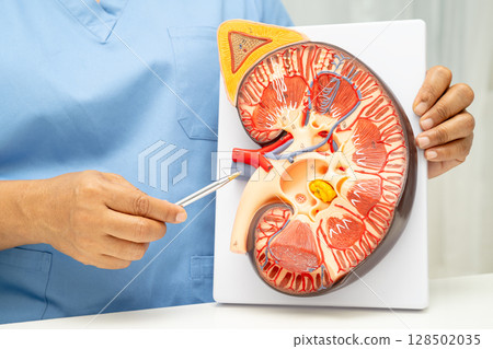 Kidney disease, Chronic kidney disease ckd, Doctor hold human model to treat and study in hospital. 128502035
