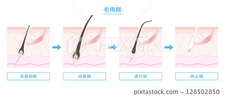 毛髮生長週期圖解（生長期、退化期、休止期） 128502850