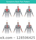 A series of anatomical diagrams illustrating various common patterns of back pain and referred pain in the human upper back, shoulders, and arms. 128506425