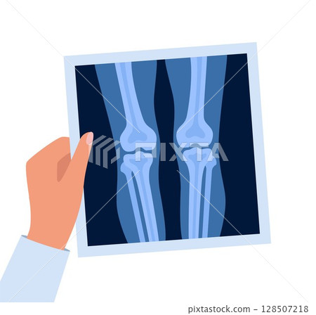 Xray of human knees bones and joints, examination and diagnosis. Roentgen shot in doctors hand. Vector illustration. 128507218