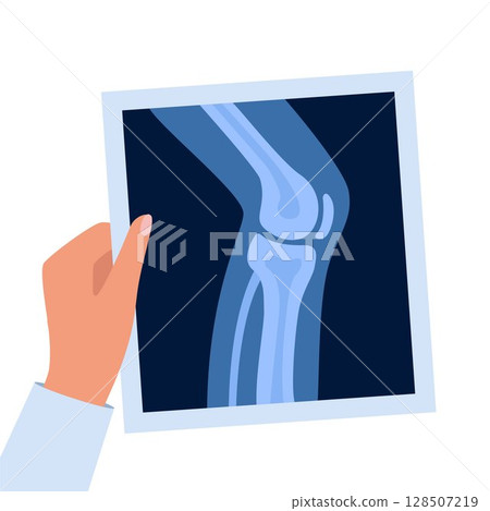 X-ray anatomy of the knee joint and human leg. Roentgen shot in doctors hand. Vector illustration. X-ray anatomy of the knee joint and human leg. Roentgen shot in doctors hand. Vector illustration. 128507219
