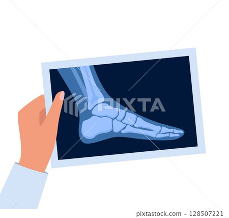 X ray human foot. X-ray picture or radiographic monitor image of metatarsus bones and toes. Medical radiology. Roentgen shot in doctors hand. Vector illustration. 128507221