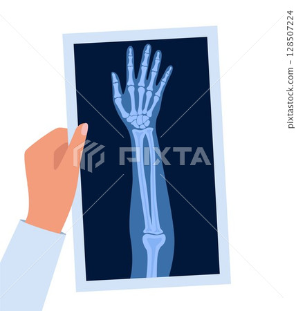X ray human hand. Body bone roentgen front view. Medical anatomy. Arm checking healthcare joint palm finger exam. Roentgen shot in doctors hand. Vector illustration. X ray human hand. Body bone roentgen front view. Medical anatomy. Arm checking healthcare joint palm finger exam. Roentgen shot in doctors hand. Vector illustration. 128507224