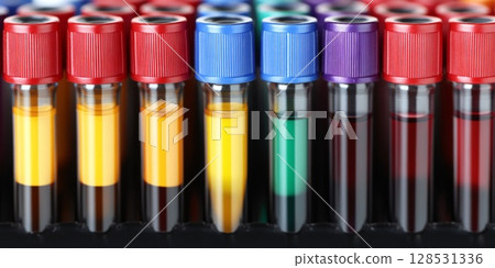 Neatly aligned blood test tubes with red, yellow, and purple lids, symbolizing effective sample management and diversity of diagnostic tests. Neatly aligned blood test tubes with red, yellow, and purple lids, symbolizing effective sample management and diversity of diagnostic tests. 128531336