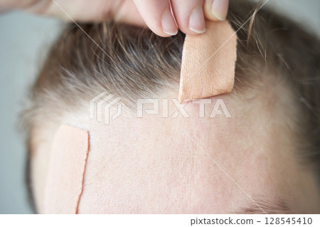 Caucasian female applying healing bandage on forehead wound for skin care Caucasian female applying healing bandage on forehead wound for skin care 128545410