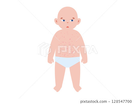 The most common viral rashes 128547700
