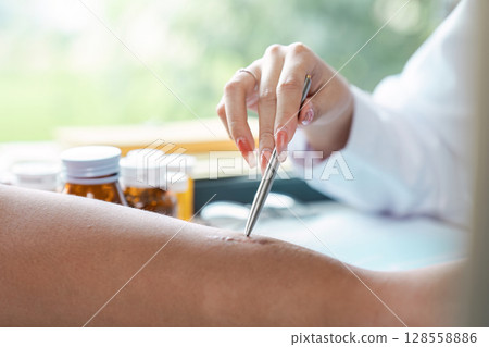Close-up of Doctor Treating Patient's Arm with Medical Instrument in a Clinical Setting 128558886