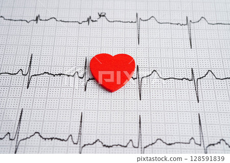 Electrocardiogram ECG, heart wave, heart attack, cardiogram report. 128591839