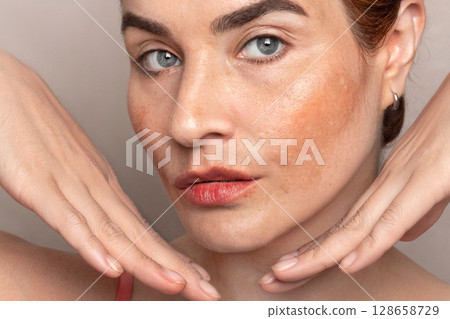 Woman shows her face with pigmentation, melasma, freckles, age spots photo. Close up photo Woman shows her face with pigmentation, melasma, freckles, age spots photo. Close up photo 128658729