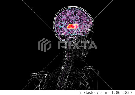 Thalamus of human brain, 3D illustration showing the paired deep gray matter structures that relay sensory and motor signals to the cerebral cortex. 128663830