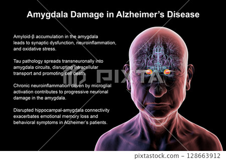 Senior person with Alzheimer's disease, 3D illustration showing highlighted amygdala, a region involved in emotion and memory, commonly affected by neurodegeneration in Alzheimer's. Senior person with Alzheimer's disease, 3D illustration showing highlighted amygdala, a region involved in emotion and memory, commonly affected by neurodegeneration in Alzheimer's. 128663912