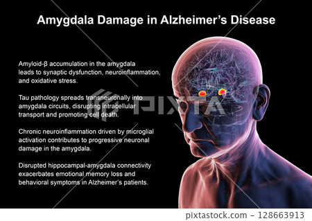 Senior person with Alzheimer's disease, 3D illustration showing highlighted amygdala, a region involved in emotion and memory, commonly affected by neurodegeneration in Alzheimer's. 128663913