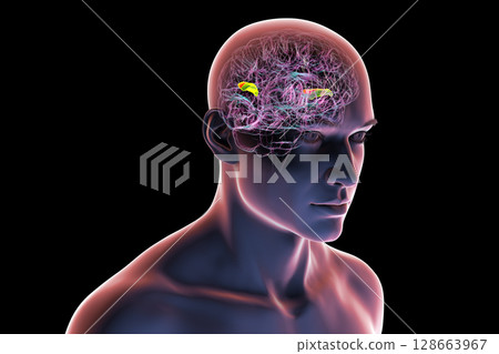 Human brain with the transverse temporal gyri highlighted, anterior in green and posterior in orange, 3D illustration. These regions are involved in auditory processing and language comprehension. Human brain with the transverse temporal gyri highlighted, anterior in green and posterior in orange, 3D illustration. These regions are involved in auditory processing and language comprehension. 128663967