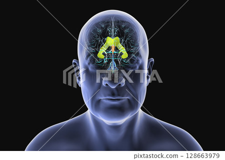 Human brain with colored ventricles, 3D illustration, lateral (yellow), third (orange), fourth (blue), interventricular foramen (green), cerebral aqueduct (dark purple), spinal channel (light purple). 128663979