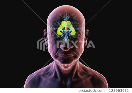 Human brain with colored ventricles, 3D illustration, lateral (yellow), third (orange), fourth (blue), interventricular foramen (green), cerebral aqueduct (dark purple), spinal channel (light purple). 128663981