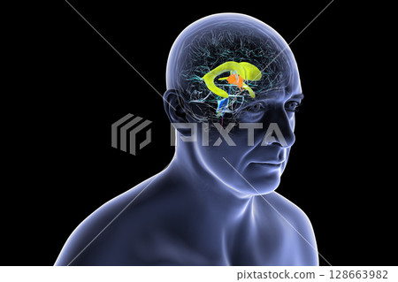 Human brain with colored ventricles, 3D illustration, lateral (yellow), third (orange), fourth (blue), interventricular foramen (green), cerebral aqueduct (dark purple), spinal channel (light purple). 128663982