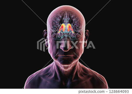 Human brain in a senior person with highlighted caudate nucleus, a region involved in motor and cognitive functions, often affected in aging, Alzheimer's, and Parkinsonian disorders, 3D illustration. Human brain in a senior person with highlighted caudate nucleus, a region involved in motor and cognitive functions, often affected in aging, Alzheimer's, and Parkinsonian disorders, 3D illustration. 128664093
