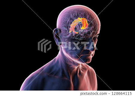 Human brain in a senior person with highlighted cingulate gyrus, a region involved in emotion, memory, and attention, often affected in aging, Alzheimer's disease, and depression, 3D illustration. Human brain in a senior person with highlighted cingulate gyrus, a region involved in emotion, memory, and attention, often affected in aging, Alzheimer's disease, and depression, 3D illustration. 128664115