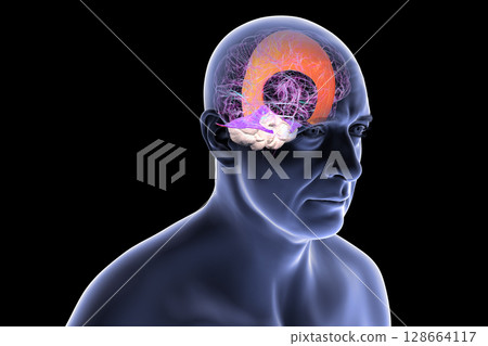 Human brain with highlighted falx cerebri and tentorium cerebelli, major dural folds separating brain hemispheres and cerebellum for structural support and protection, 3D illustration. Human brain with highlighted falx cerebri and tentorium cerebelli, major dural folds separating brain hemispheres and cerebellum for structural support and protection, 3D illustration. 128664117