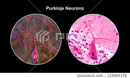 Purkinje neurons, 3D illustration and light micrograph showing large, branching neurons of the cerebellar cortex, involved in motor coordination, and affected in ataxias. 128664156