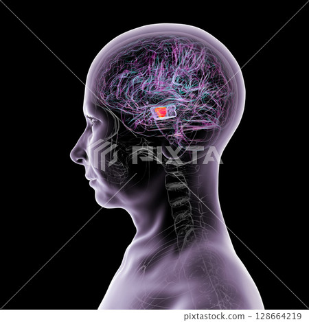 Human brain with highlighted substantia nigra in the midbrain, a key structure involved in movement regulation and affected in Parkinson's disease, 3D illustration. 128664219