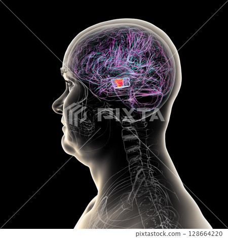 Human brain with highlighted substantia nigra in the midbrain, a key structure involved in movement regulation and affected in Parkinson's disease, 3D illustration. 128664220