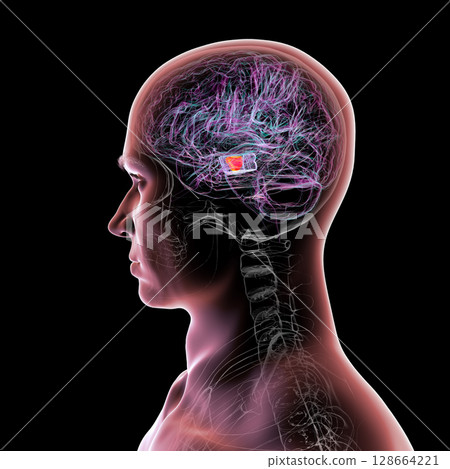 Human brain with highlighted substantia nigra in the midbrain, a key structure involved in movement regulation and affected in Parkinson's disease, 3D illustration. 128664221