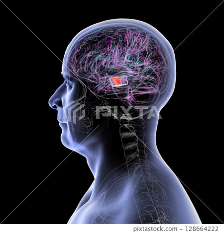 Human brain with highlighted substantia nigra in the midbrain, a key structure involved in movement regulation and affected in Parkinson's disease, 3D illustration. 128664222