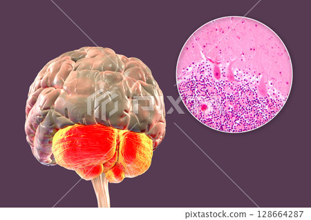 Human brain with highlighted cerebellum and close-up of Purkinje neurons, 3D illustration and light micrograph. 128664287