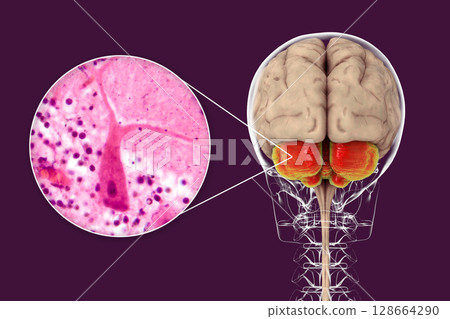 Human brain with highlighted cerebellum and close-up of Purkinje neurons, 3D illustration and light micrograph. Human brain with highlighted cerebellum and close-up of Purkinje neurons, 3D illustration and light micrograph. 128664290