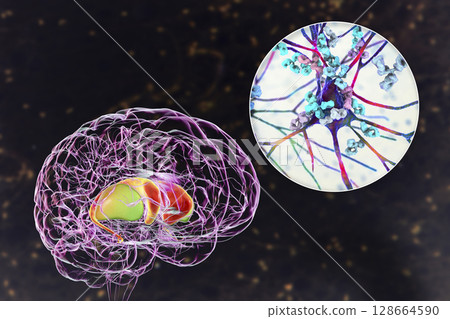 Anti-basal ganglia antibodies. 3D conceptual illustration 128664590