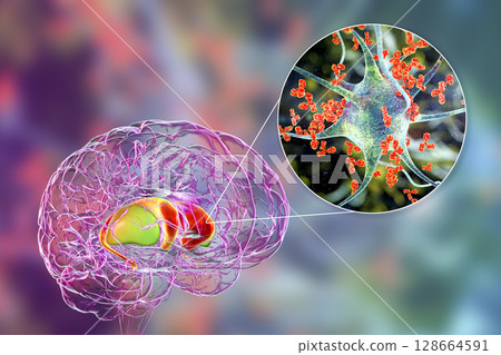 Anti-basal ganglia antibodies. 3D conceptual illustration 128664591