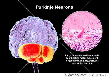 Human brain with highlighted cerebellum and close-up of Purkinje neurons, 3D illustration and light micrograph. Human brain with highlighted cerebellum and close-up of Purkinje neurons, 3D illustration and light micrograph. 128664622