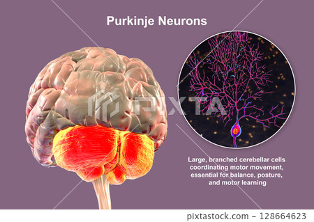 Human brain with highlighted cerebellum and close-up of Purkinje neurons, 3D illustration. Cerebellum controls balance and coordination, Purkinje cells are key neurons in motor function. Human brain with highlighted cerebellum and close-up of Purkinje neurons, 3D illustration. Cerebellum controls balance and coordination, Purkinje cells are key neurons in motor function. 128664623