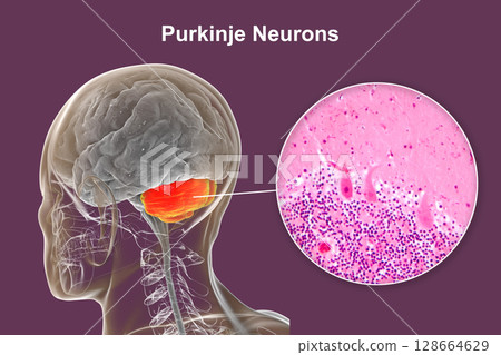 Human brain with highlighted cerebellum and close-up of Purkinje neurons, 3D illustration and light micrograph. Human brain with highlighted cerebellum and close-up of Purkinje neurons, 3D illustration and light micrograph. 128664629