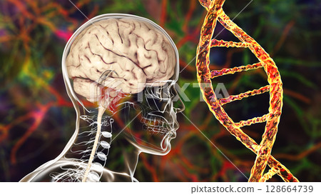 Genetic brain disorders, conceptual 3D illustration. Mutations in the DNA leading to brain diseases. Neurodegenerative disorders Genetic brain disorders, conceptual 3D illustration. Mutations in the DNA leading to brain diseases. Neurodegenerative disorders 128664739