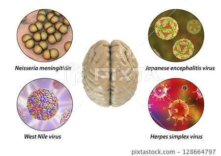 Microorganisms that cause brain infections 128664797