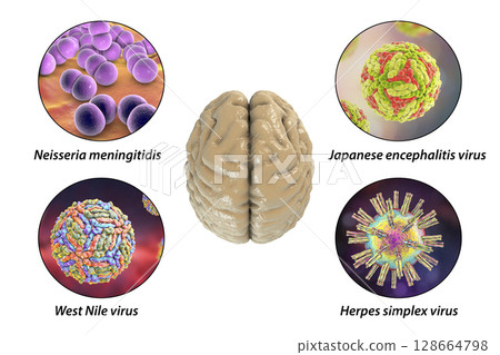Microorganisms that cause brain infections 128664798