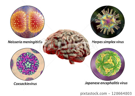 Microorganisms that cause brain infections Microorganisms that cause brain infections 128664803