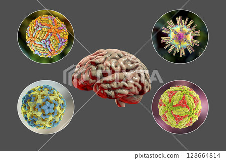 Microorganisms that cause brain infections 128664814